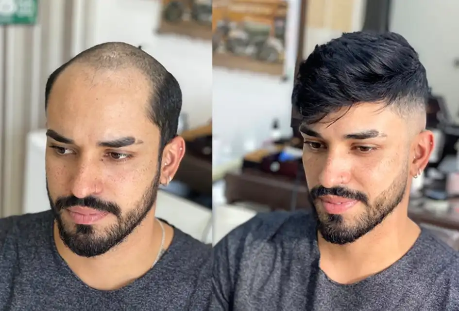 transformation for men and women in Delhi