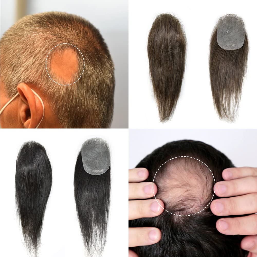 Premium human hair patch for men and women in Delhi